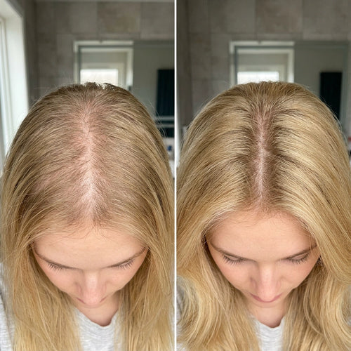 Korean Hair Loss Prevention Shampoo Bar
