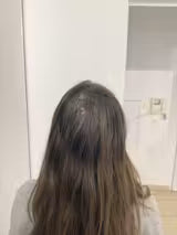Korean Hair Loss Prevention Shampoo Bar